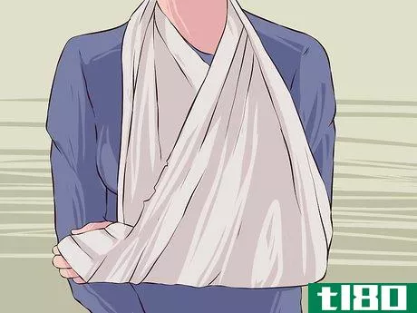 Image titled Apply First Aid without Bandages Step 18