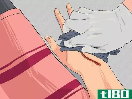 Image titled Apply First Aid without Bandages Step 11