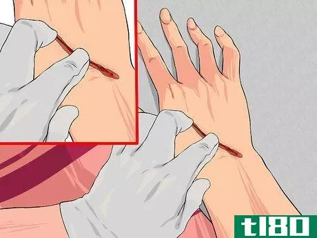 Image titled Apply First Aid without Bandages Step 12