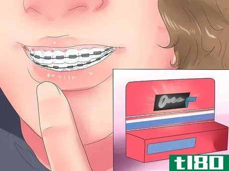 Image titled Alleviate Orthodontic Brace Pain Step 7