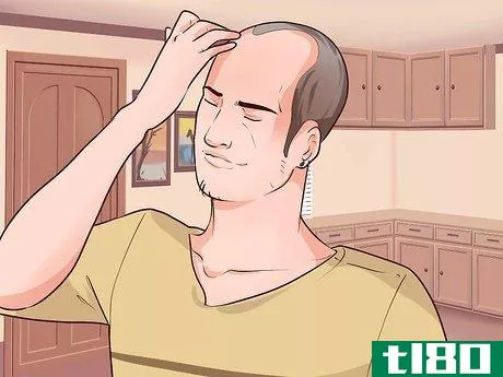 Image titled Adjust to Hair Loss and Baldness Step 3