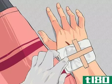 Image titled Apply First Aid without Bandages Step 16