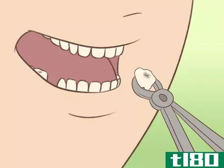 Image titled Alleviate Toothache Pain Step 11