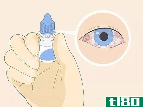 Image titled Administer Eye Drops Step 13