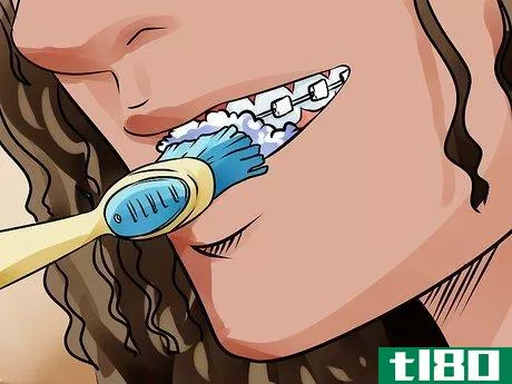 Image titled Apply Dental Wax on Braces Step 6
