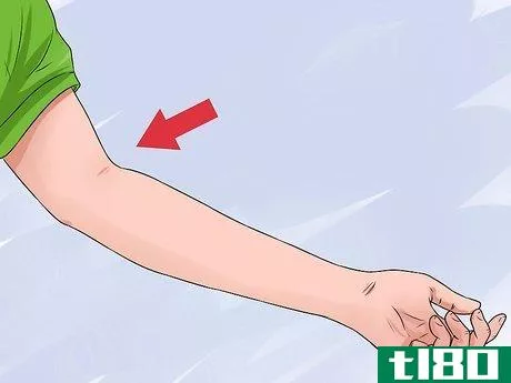 Image titled Properly Place a TB Skin Test Step 9