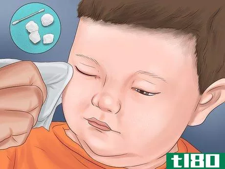 Image titled Administer Eye Drops in Children Step 12