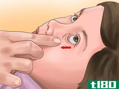 Image titled Administer Eye Drops in Children Step 13