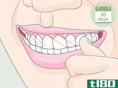 Image titled Apply Crest 3D White Strips Step 9