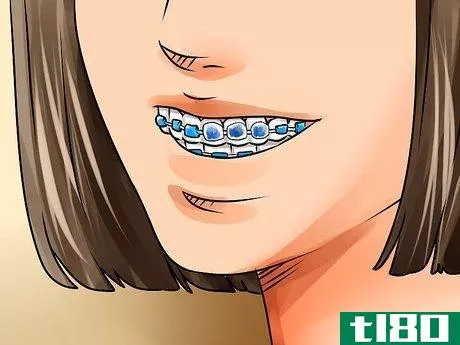 Image titled Apply Dental Wax on Braces Step 9