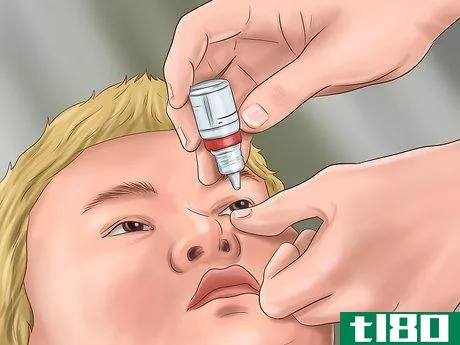 Image titled Administer Eye Drops in Children Step 24