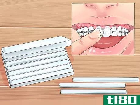 Image titled Alleviate Orthodontic Brace Pain Step 10