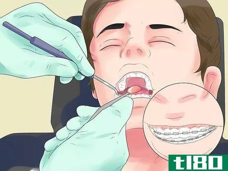 Image titled Alleviate Orthodontic Brace Pain Step 18