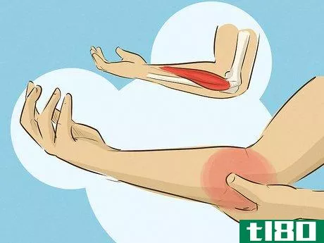 Image titled Assess Forearm Tendinitis Step 2