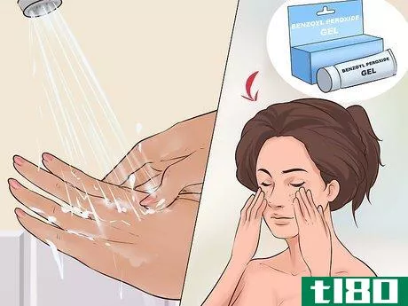 Image titled Avoid Negative Effects of Benzoyl Peroxide Step 6