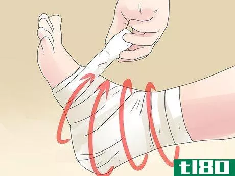 Image titled Tape a High Ankle Sprain Step 7