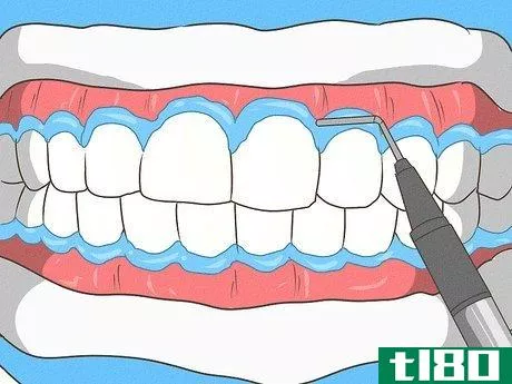 如何避免伤害到你的牙龈(avoid hurting your gums)