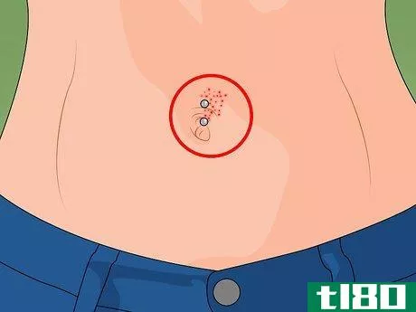 Image titled Care for a New Navel Piercing Step 14