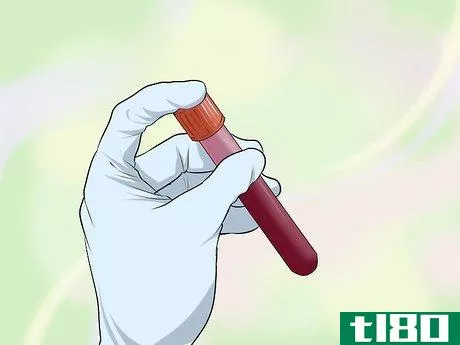 Image titled Test for Insulin Resistance Step 3