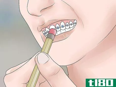 Image titled Be Happy with Braces Step 12
