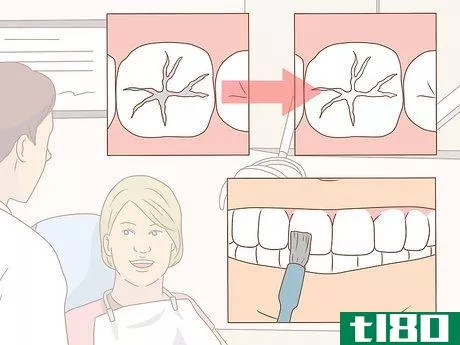 Image titled Take Good Care of Your Teeth Step 14