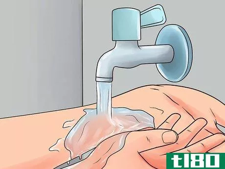 Image titled Avoid a Stomach Virus After Being Exposed Step 10