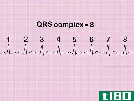 Image titled Calculate Heart Rate from ECG Step 6