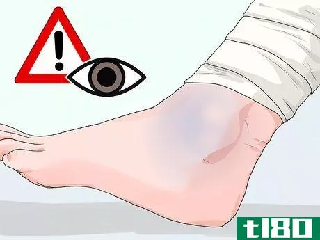 Image titled Apply a Pressure Bandage Step 4