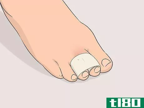 Image titled Buddy Tape an Injured Toe Step 3