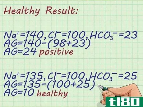 Image titled Calculate Anion Gap Step 7