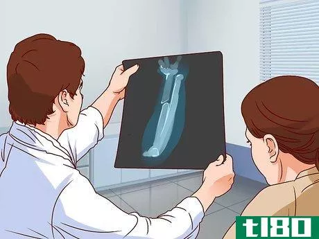 Image titled Apply a Cast to a Broken Arm Step 4