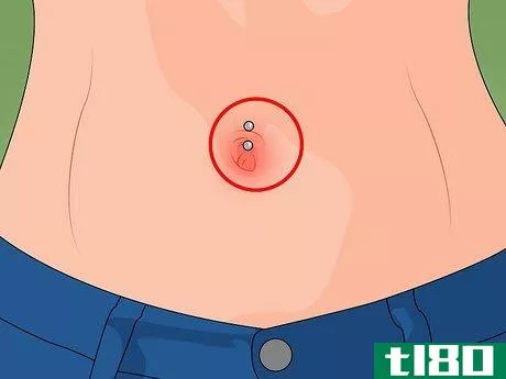 Image titled Care for a New Navel Piercing Step 12