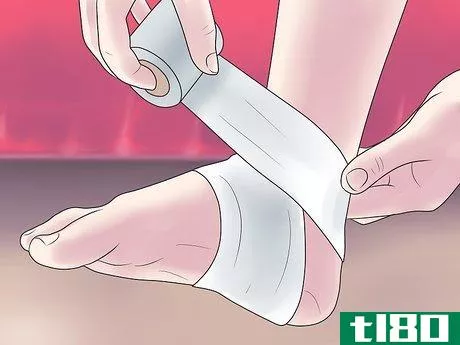 Image titled Treat a Broken Ankle Step 10