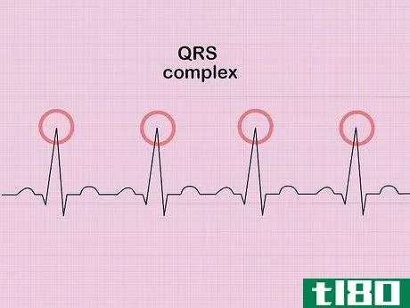 Image titled Calculate Heart Rate from ECG Step 2