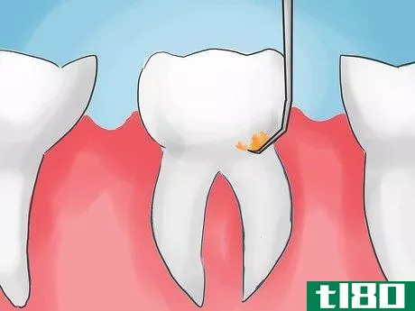 Image titled Avoid Gum Disease Problems Step 09