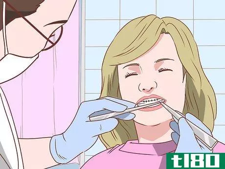 Image titled Avoid Pain When Your Braces Are Tightened Step 5