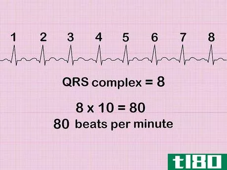 Image titled Calculate Heart Rate from ECG Step 7