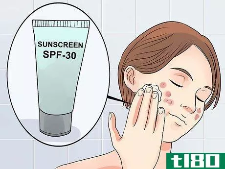 Image titled Get Rid of Acne if You Have Fair Skin Step 15