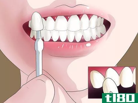 Image titled Bleach Your Teeth Step 7