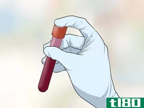 Image titled Get Tested for STDs Without Letting Your Parents Know Step 4