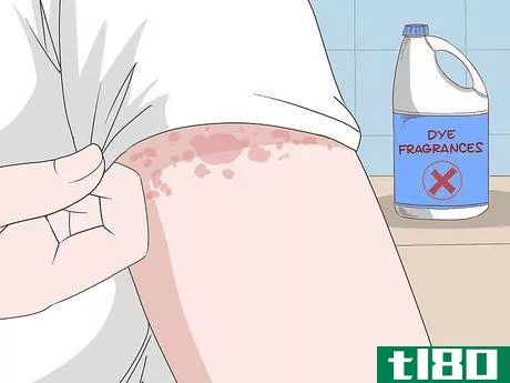 Image titled Avoid Triggers for Chronic Hives Step 6