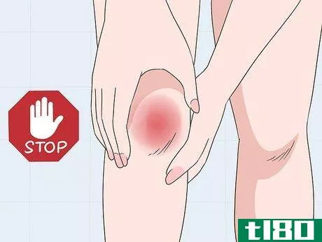 Image titled Avoid Patellar Tendonitis Step 5