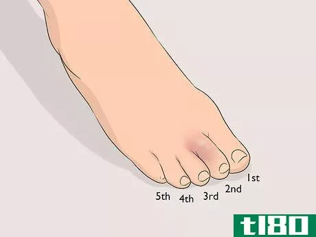 Image titled Buddy Tape an Injured Toe Step 1