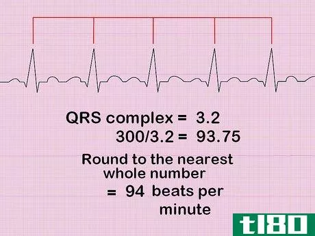 Image titled Calculate Heart Rate from ECG Step 4