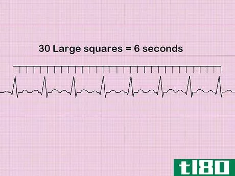 Image titled Calculate Heart Rate from ECG Step 5