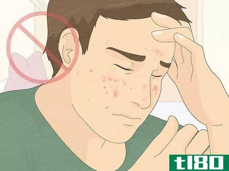 Image titled Be Confident If You Have Acne Step 11