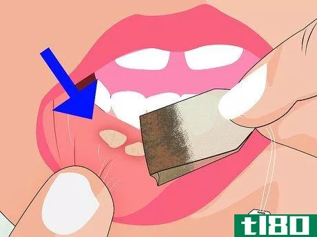 Image titled Avoid Getting Canker Sores Step 9