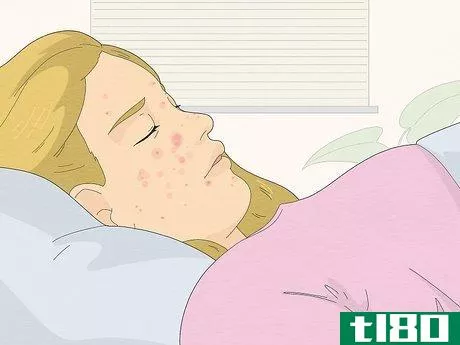 Image titled Be Confident If You Have Acne Step 16