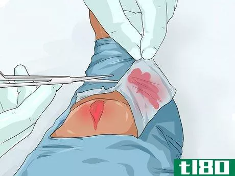 Image titled Apply a Pressure Bandage Step 2