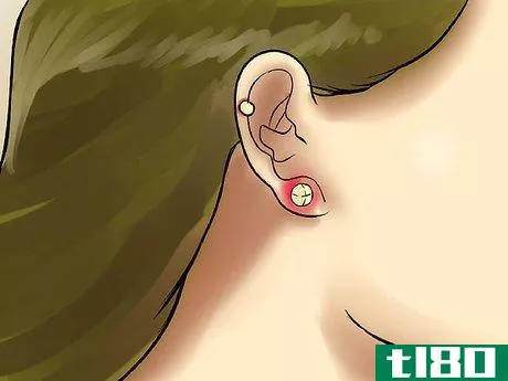 Image titled Care for an Auricle Piercing Step 8